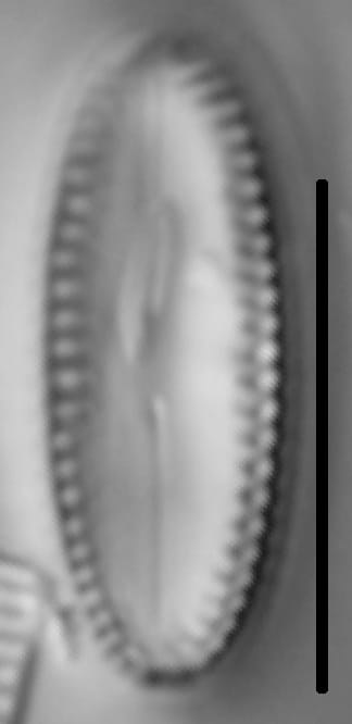 Diatomella balfouriana LM3