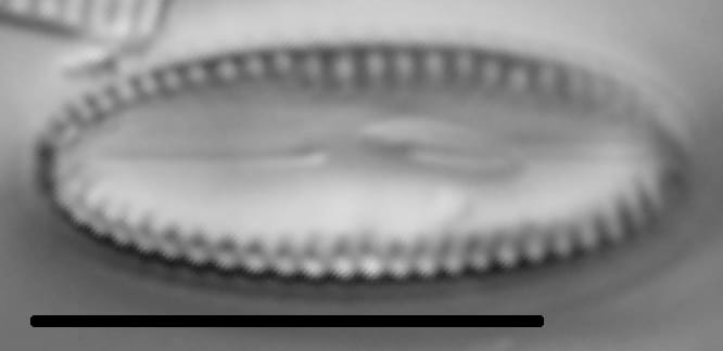 Diatomella balfouriana LM3