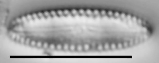 Diatomella balfouriana LM5