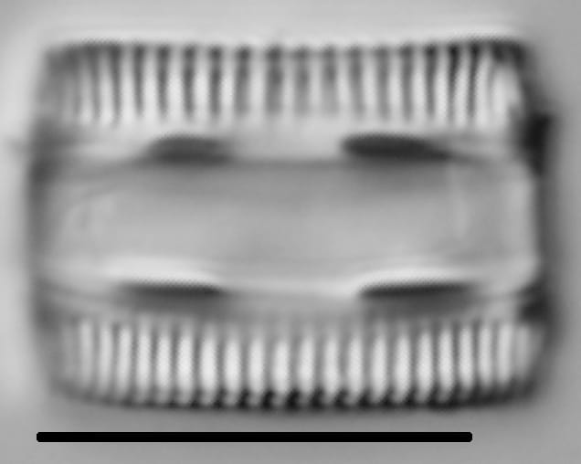 Diatomella balfouriana LM6