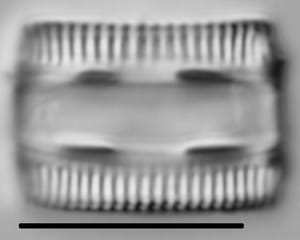 Diatomella balfouriana LM6