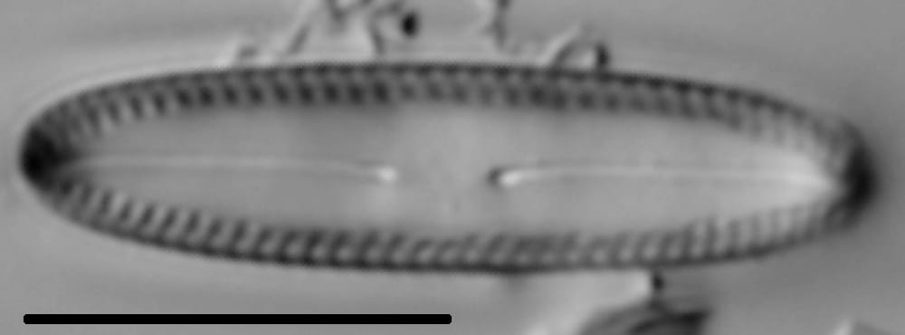 Diatomella balfouriana LM7