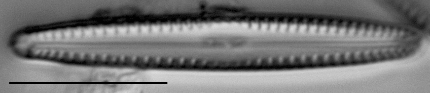 Gomphonema apuncto LM1