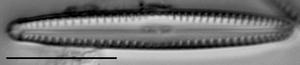 Gomphonema apuncto LM1