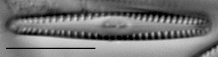 Gomphonema apuncto LM3