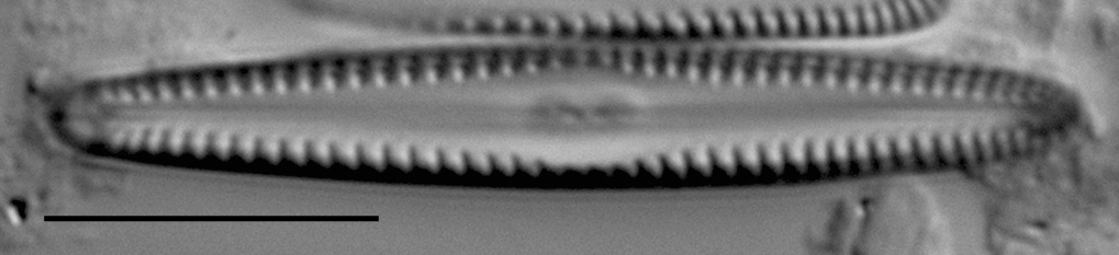 Gomphonema apuncto LM4