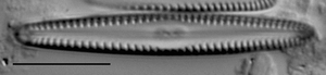 Gomphonema apuncto LM4