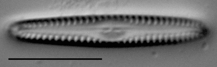 Gomphonema apuncto LM5