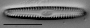 Gomphonema apuncto LM5