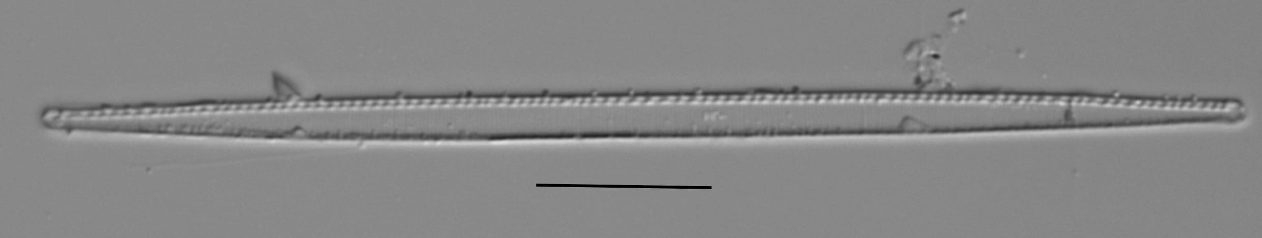 Duplicate Gracilis 112594 001