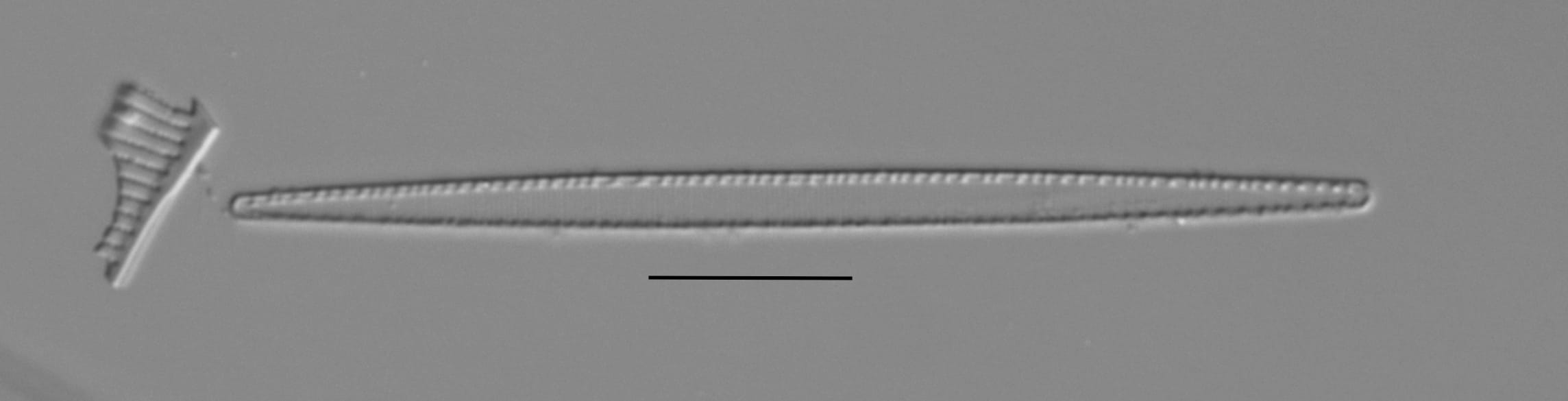 Duplicate Gracilis 112594 004