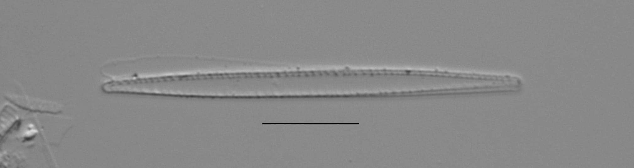 Duplicate Gracilis 112594 005