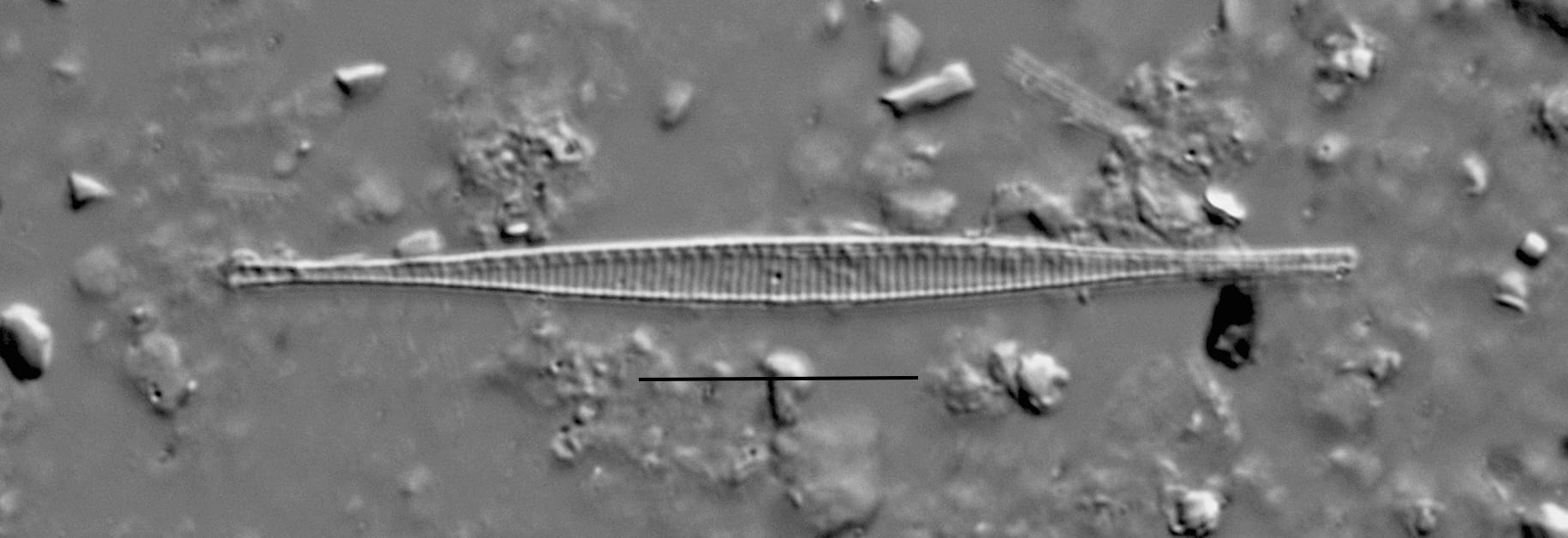 Duplicate Subacicularis 113596B 002