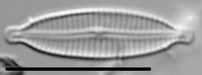 Encyonemopsis Subminuta 003