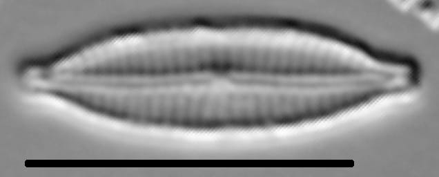 Encyonemopsis Subminuta 004