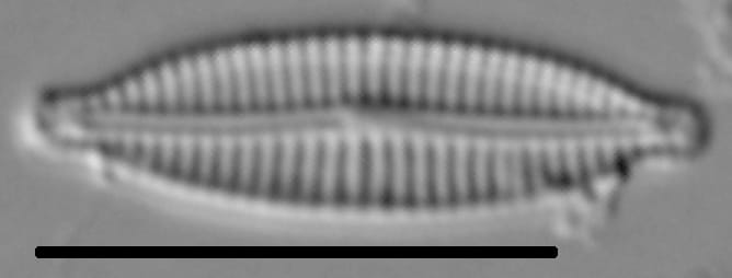 Encyonemopsis Subminuta 006