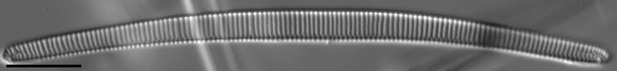 Eunotia Naegelii Short Ii