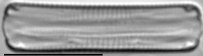 Eunotia Paludosa Girdle C