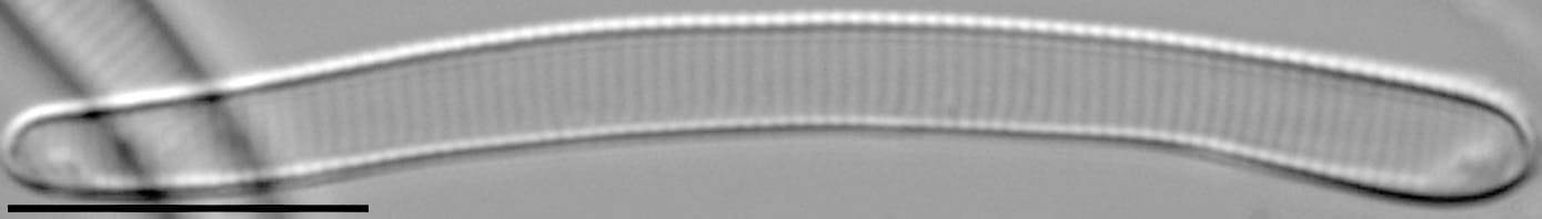 Eunotia Paludosa Initialvalve C