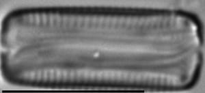 Eunotia trinacria LM4