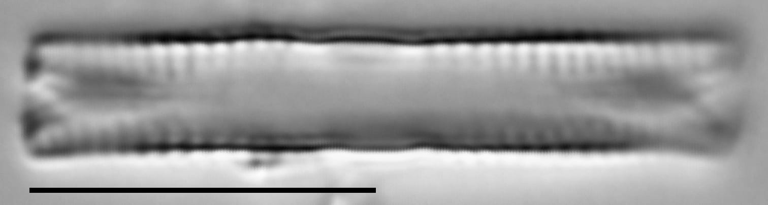 Fragilaria recapitellata LM1