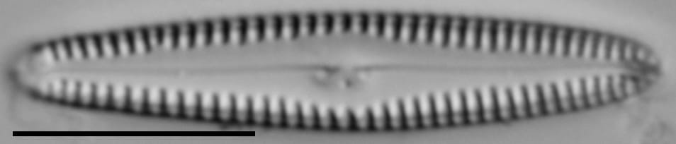 Gomphonema caperatum LM1