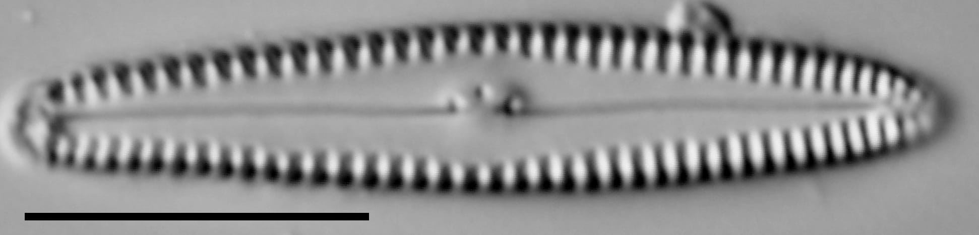 Gomphonema caperatum LM2