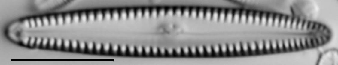 Gomphonema caperatum LM3