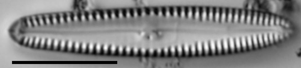 Gomphonema caperatum LM4