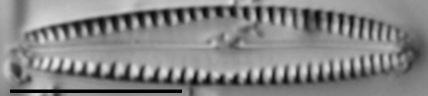 Gomphonema caperatum LM5