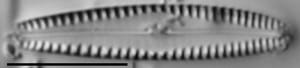 Gomphonema caperatum LM5