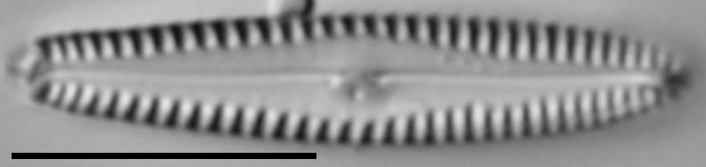 Gomphonema caperatum LM6