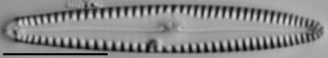 Gomphonema caperatum LM7