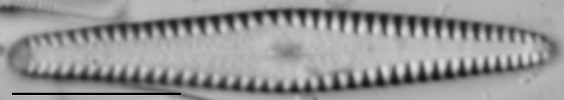 Gomphonema louisiananum LM3