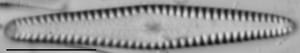 Gomphonema louisiananum LM3