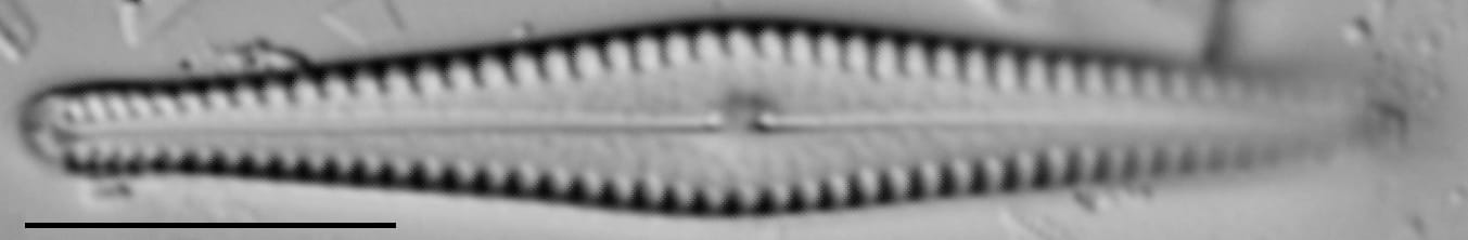 Gomphonema louisiananum LM1