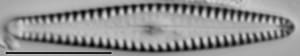 Gomphonema louisiananum LM4