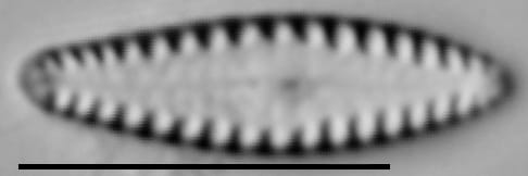 Gomphonema louisiananum LM7