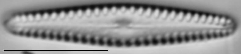 Gomphonema louisiananum LM5