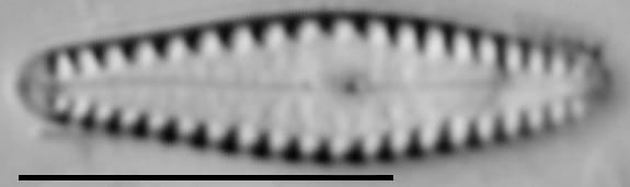 Gomphonema louisiananum LM6