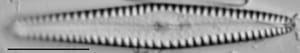 Gomphonema louisiananum LM2