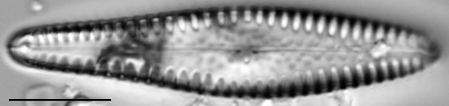 G Reimeri 15592C 02262016 01  Gomphonema  Sesqa Cl