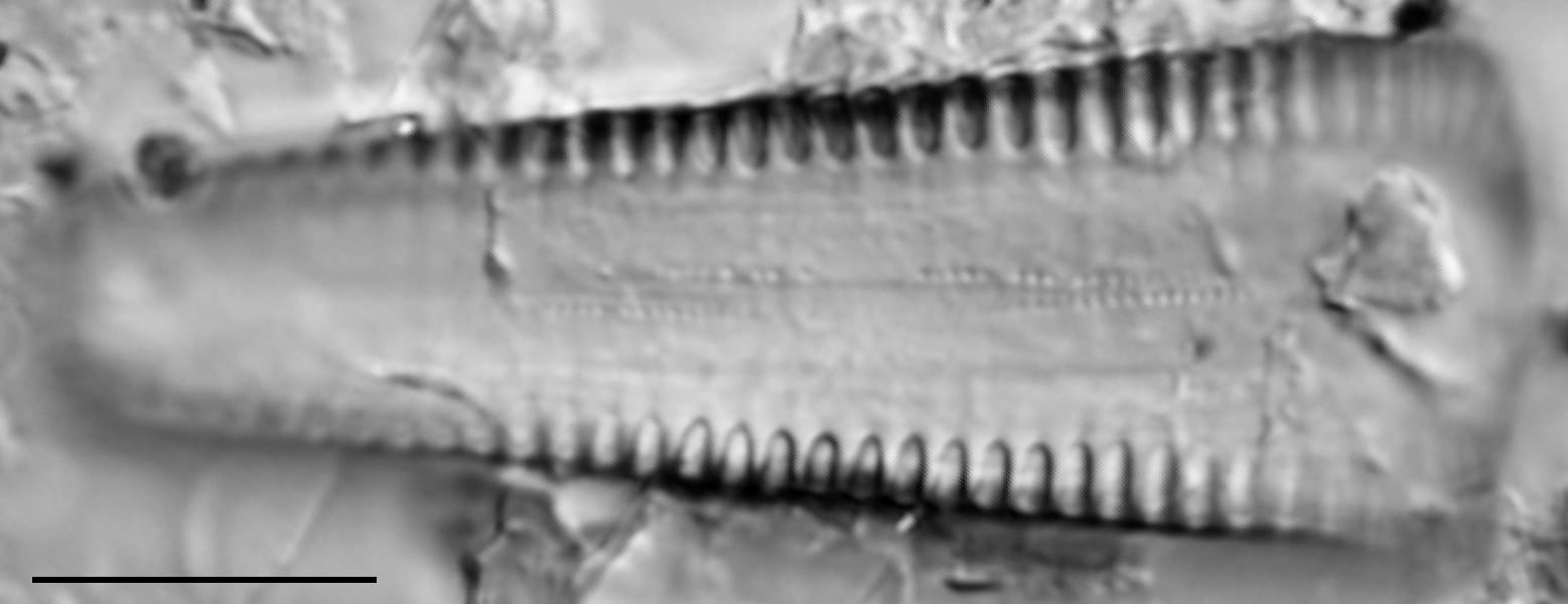 G Reimeri 15592C 02262016 02  Gomphonema  Sesqa Cl