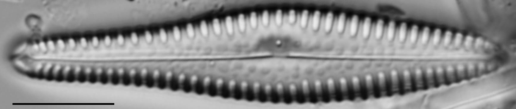 G Reimeri 15592C 02262016 05  Gomphonema  Sesqa Cl