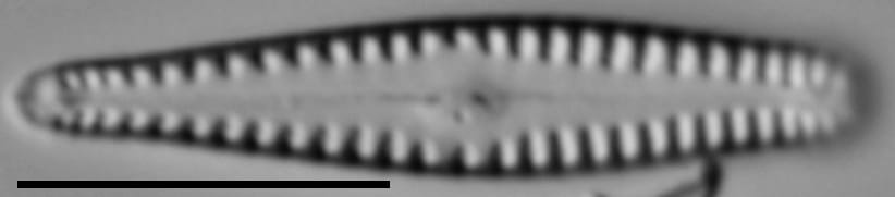 Gomphonema sierranum LM6