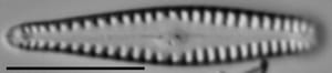 Gomphonema sierranum LM6