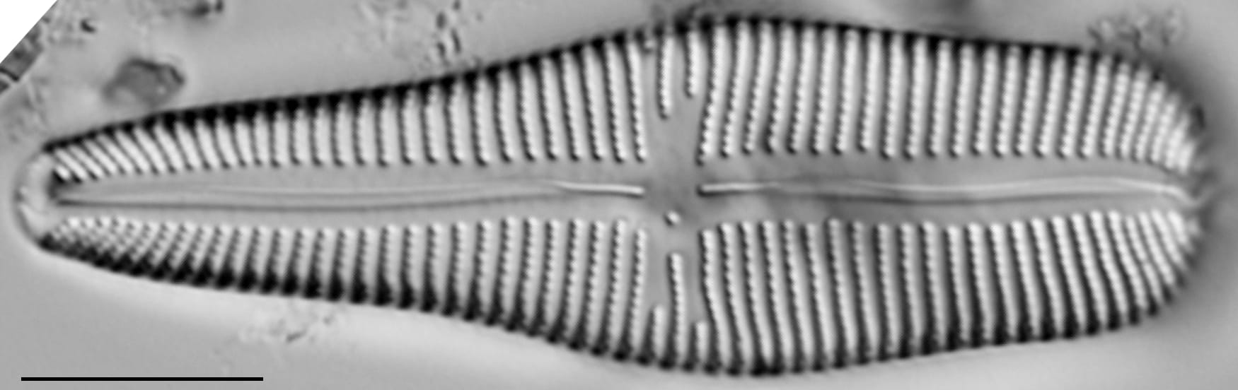 Gomp Turg 15544A 09172015 25 Cl