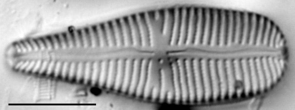 Gomp Turg 15596A 09042015 33 Cl