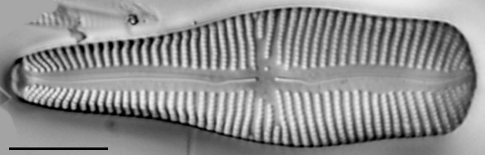 Gomp Turg 15670B 12072015 03 Cl