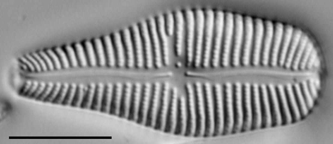 Gomp Turg 15670B 12072015 04 Cl